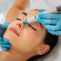 Servicio Hidrafacial -Hidrodermoabrasion    BeautyElle