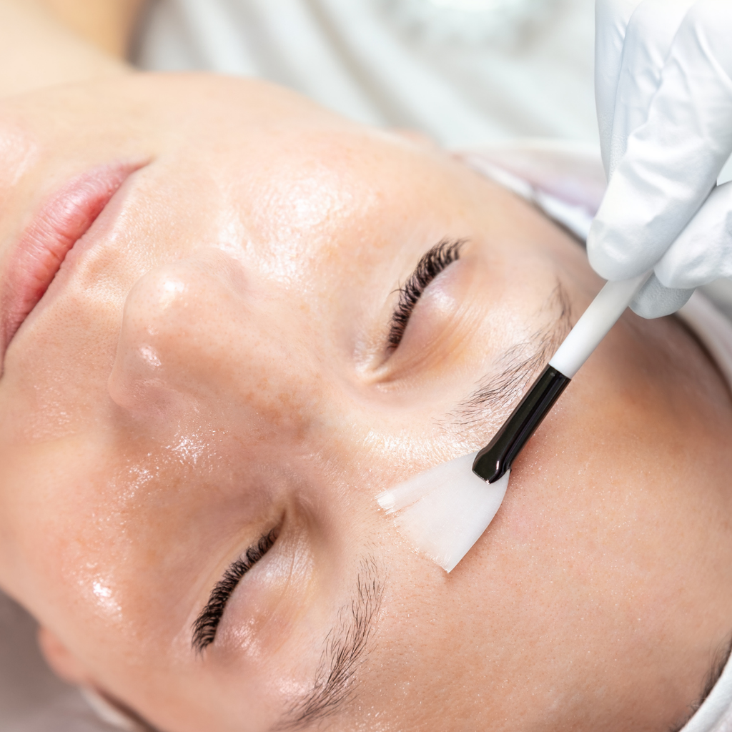 Facial Face lift con radiofrecuencia